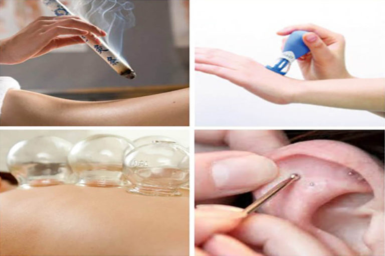 Non Acupuncture Therapies